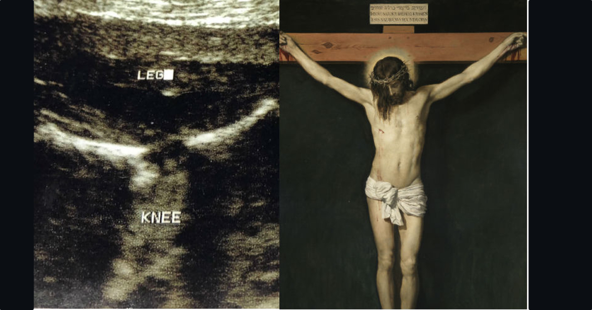 Ultrasound of a pregnant woman depicts Jesus crucified