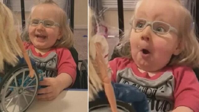 Liten flicka föddes med ryggmärgsbråck, hennes reaktion när de gav henne en barbiedocka i rullstol