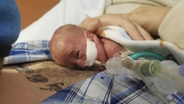 Född vid bara 21 veckor: hur den rekordstora nyfödda som mirakulöst överlevde ser ut idag